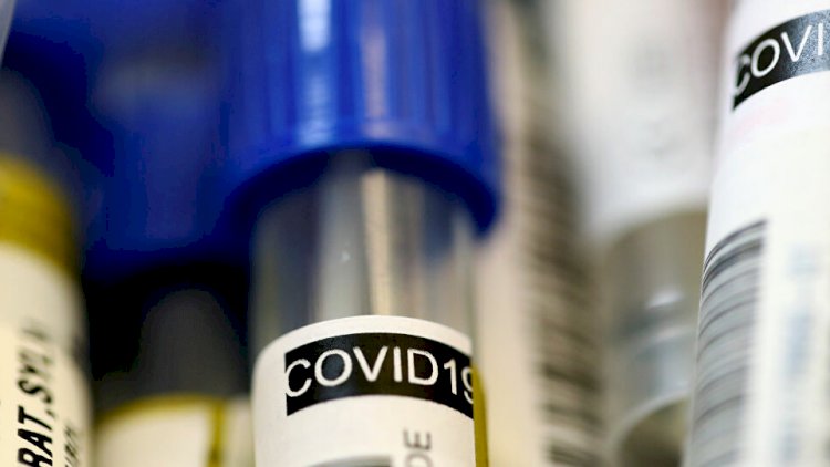 Rusiya koronavirusa qarşı 3 dərmanı sınaqdan keçirir