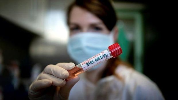 Azərbaycanda daha 104 koronavirusa yoluxma faktı qeydə alındı, 1 nəfər öldü - SON DƏQİQƏ!