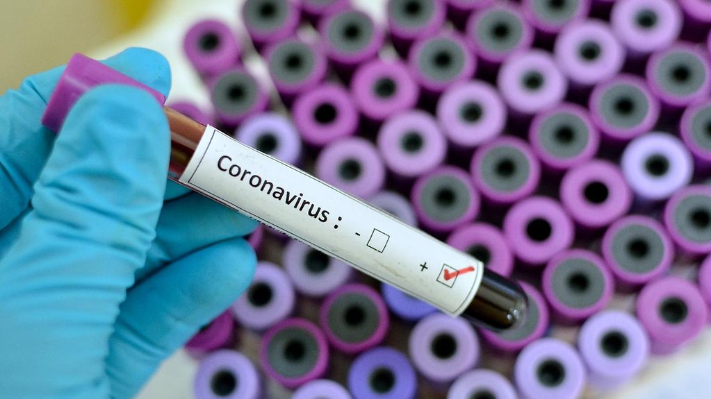 Tanınmış hakim koronavirusdan öldü - FOTO