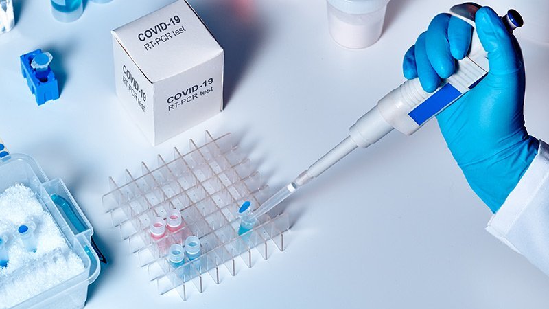 Azərbaycanda koronavirusa görə 86 607 test aparılıb - RƏSMİ