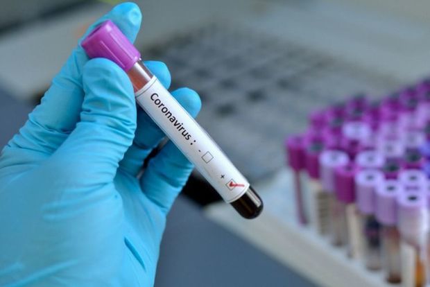 Azərbaycanda daha üç nəfər koronavirusdan öldü: 33 yeni yoluxma faktı - RƏSMİ