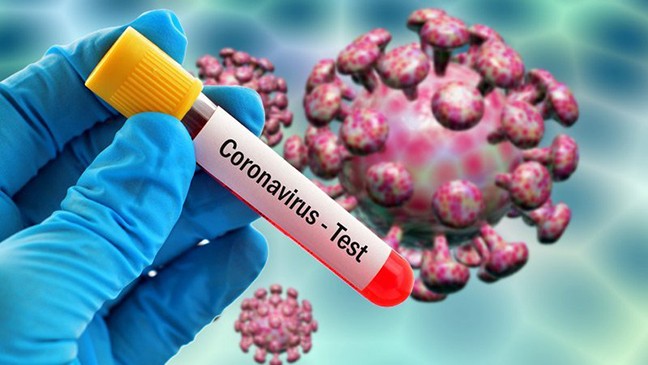 ÜST: Dünyada koronavirusa yoluxanların sayı 2,5 milyonu ötdü