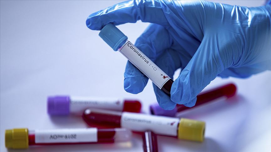 Türkiyədə koronavirusa daha 1 614 yoluxma qeydə alındı - STATİSTİKA