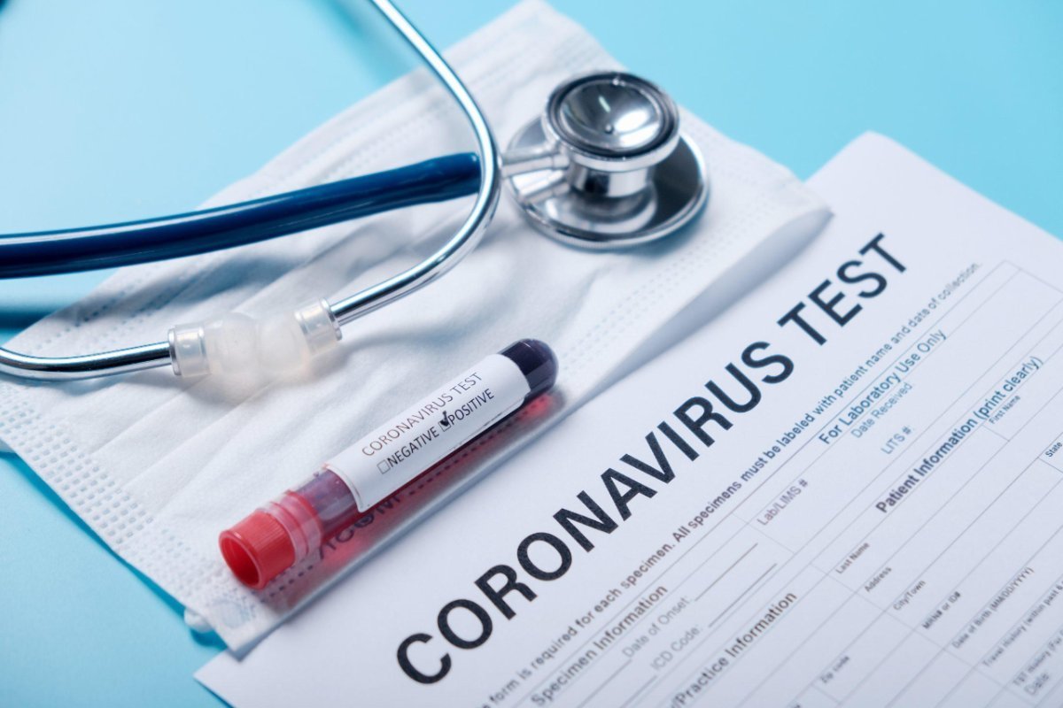 Azərbaycanda daha 113 nəfər koronavirusa yoluxub, 40 nəfər sağalıb - SON DƏQİQƏ!