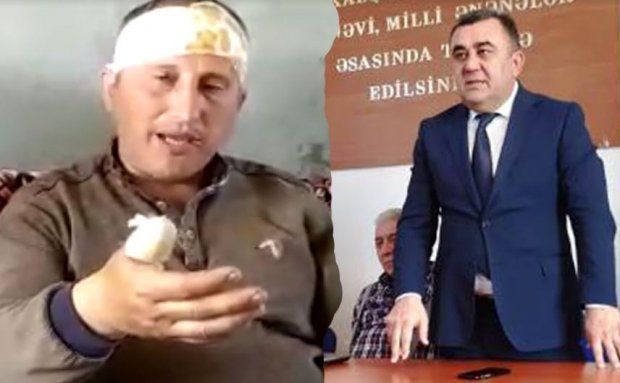 Azərbaycanda icra başçısının müavini şikayətçini döyüb pəncərədən atdı - VİDEO