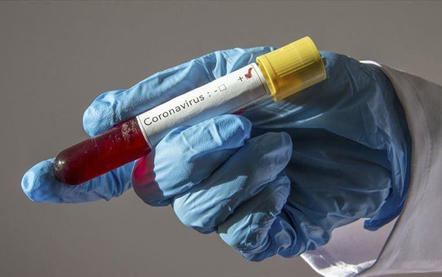 Daha 262 nəfər koronavirusa yoluxdu - 2 nəfər öldü