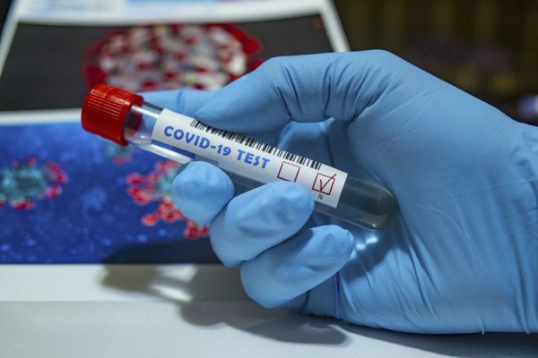 Dünyada koronavirusa yoluxanların sayı 8 milyonu ötüb