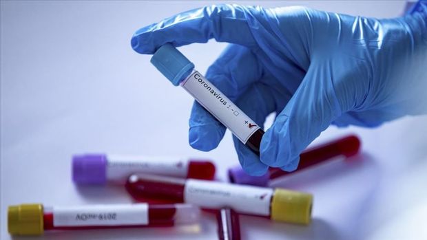 Qızdırması 37 olanlar koronavirus testindən keçməlidirmi? — RƏSMİ