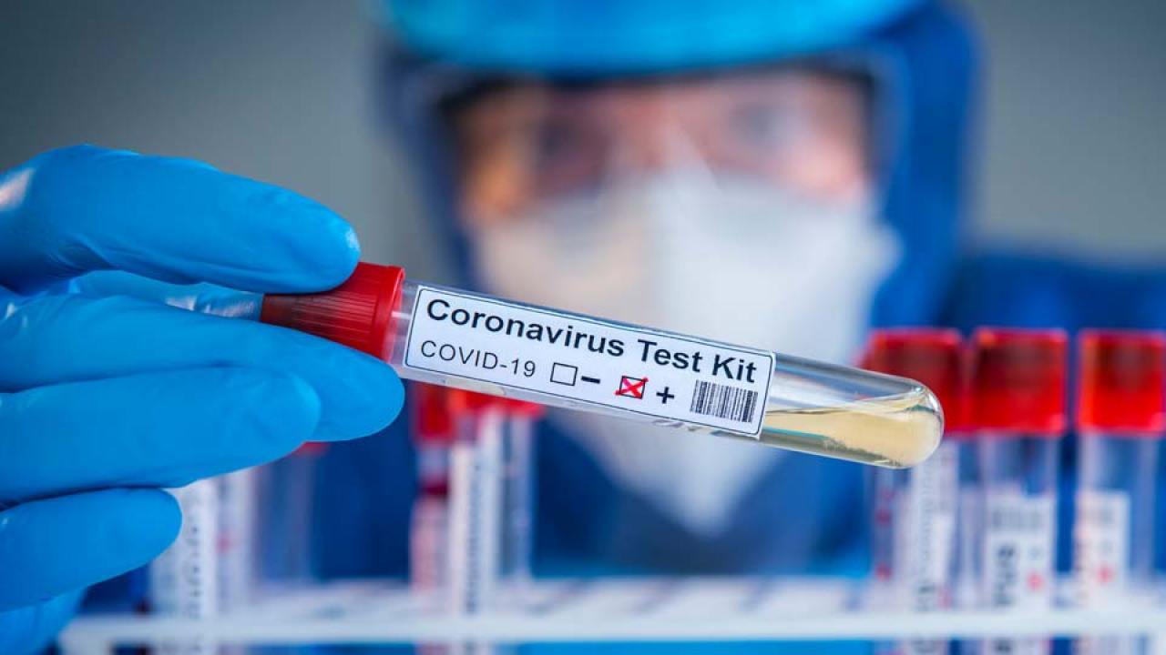 Azərbaycanda indiyədək aparılmış koronavirus testinin sayı açıqlandı