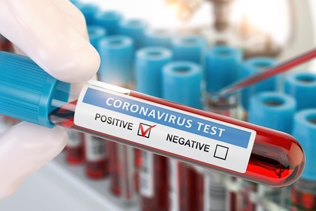 Klinikalar koronavirus testi müayinələrini dayandırdı