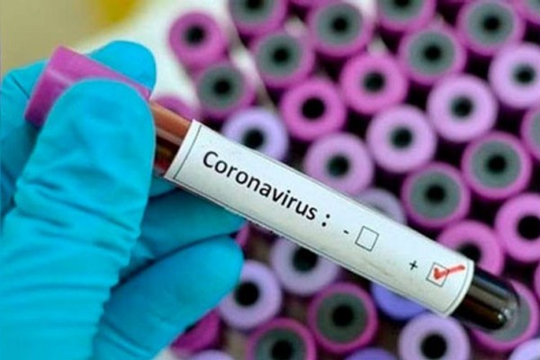 Azərbaycanda daha 526 nəfər koronavirusa yoluxdu - 8 nəfər öldü - SON DƏQİQƏ!