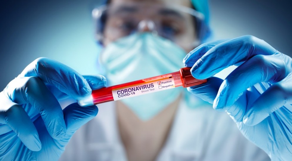 ÜST: Dünyada koronavirusa rekord yoluxma qeydə alınıb