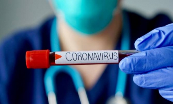 Azərbaycanda 146 nəfər koronavirusa yoluxdu, 162 nəfər sağaldı
