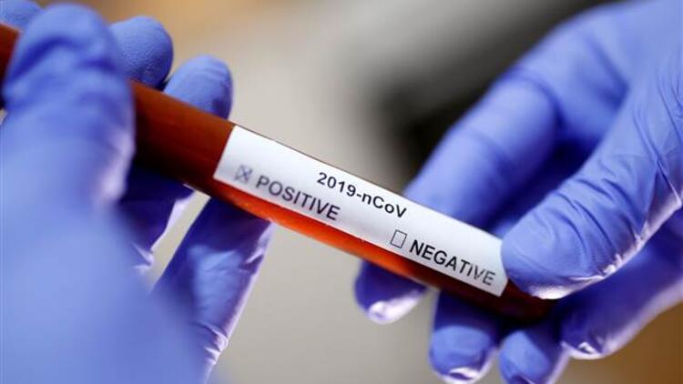 Türkiyədə son sutkada koronavirusdan 65 nəfər öldü