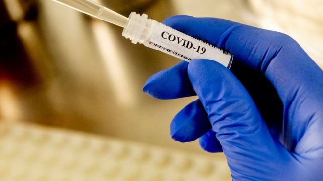 Gürcüstanda daha 471 nəfərdə koronavirus aşkarlandı, 2 nəfər öldü