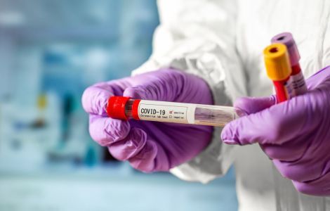 Ermənistanda koronavirus tüğyan edir: 1 gündə 543 yoluxma