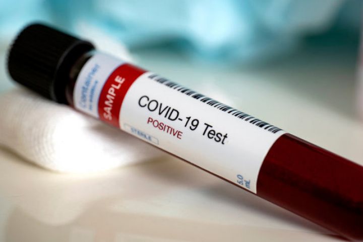 Ermənistanda koronavirus tüğyan edir - Bir gündə 614 yoluxma, 6 ölü