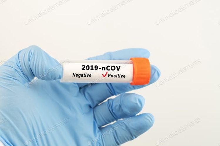 Ermənistanda daha 6 nəfər koronavirusdan öldü - 370 yoluxma