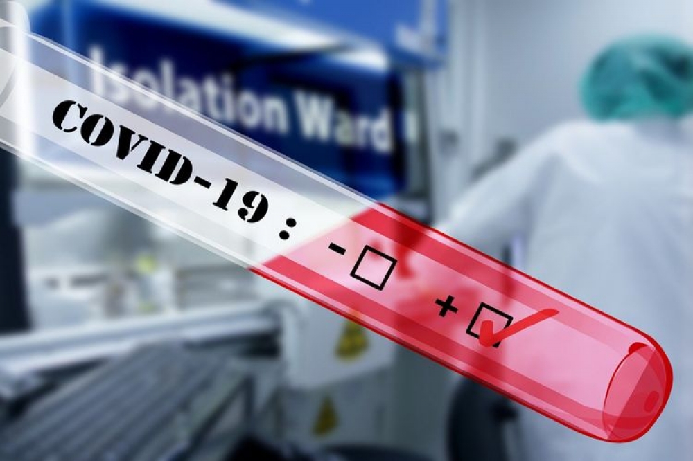 Ermənistanda koronavirus tüğyan edir: 1 540 yoluxma, 11 ölü