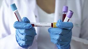 Ermənistanda koronavirus şoku: 1 sutkada 41 ölü
