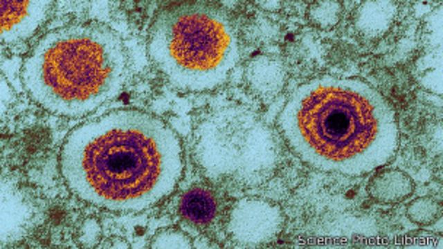 Avropada daha bir təhlükəli virus sürətlə yayılır