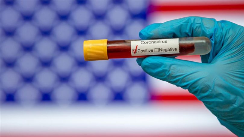 ABŞ-da son sutkada 155 mindən çox insan koronavirusa yoluxdu
