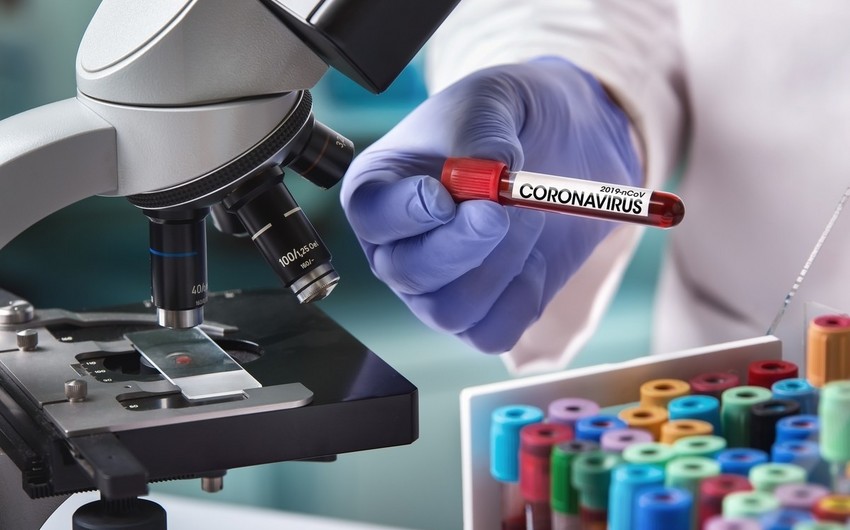 Çinli həkim etiraf etdi: “Koronavirus laboratoriyada hazırlanıb”- BU DA SÜBUT!