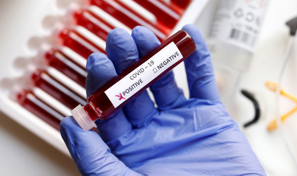 Evi tərk edən 29 aktiv koronavirus xəstəsi saxlanıldı