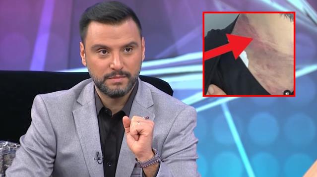 Qarın piylərindən xilas olmaq istəyən Alişan ölümdən dönüb – FOTOLAR