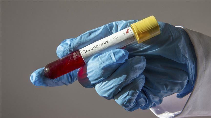 Dünyada koronavirusa yoluxanların sayı 85 milyonu keçdi