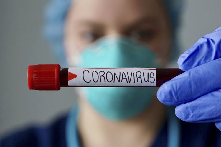 Gürcüstanda son sutkada 602 nəfər koronavirusa yoluxub, 11 nəfər ölüb
