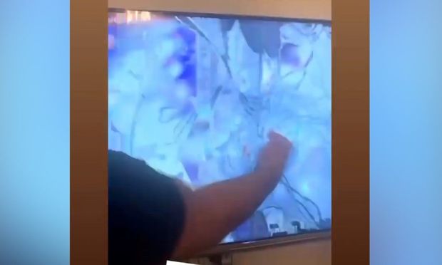 Azərbaycanlı idmançıya görə televizorun monitorunu sındırdı - VİDEO
