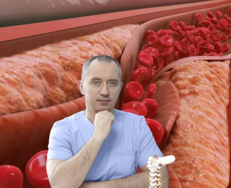 Damarların tıxanması və qanın qatılaşması xəstəlik yox, simptomdur – Həkim əsl səbəbi AÇIQLADI