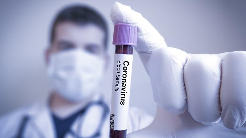 Koronavirusa yoluxma sayında artım, 15 nəfər öldü