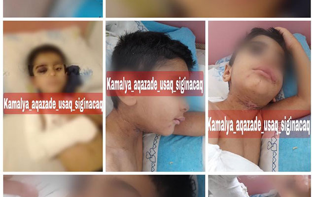 5 yaşlı uşağın döyülməsi hadisəsi nəzarətə götürüldü