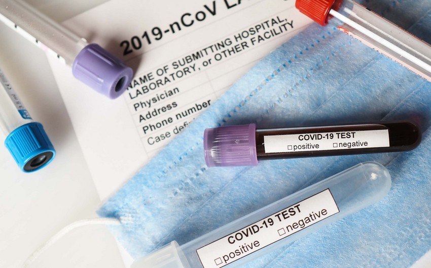Koronavirusa yoluxma sayı açıqlandı, ölüm sayı 21 oldu