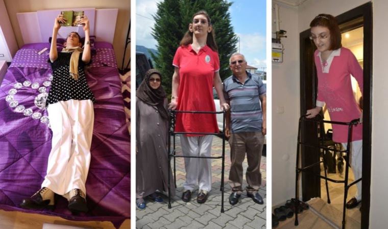 Dünyanın ən uzun qadını titulunu türkiyəli xanım qazanıb - Foto