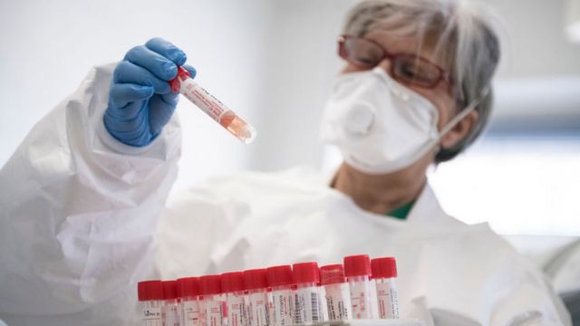 “Pfizer” ağır koronavirus xəstələri üçün yeni dərman hazırladı - Ölümdən qoruyur