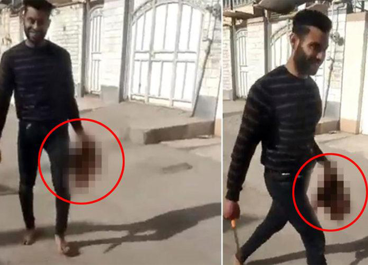 Əri və qardaşı Türkiyəyə qaçan iranlı qadının başını kəsdi