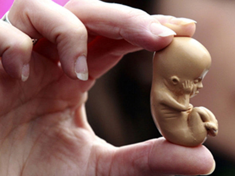 Azərbaycanda abortların sayı artır – Ötən il rekord qeydə alınıb