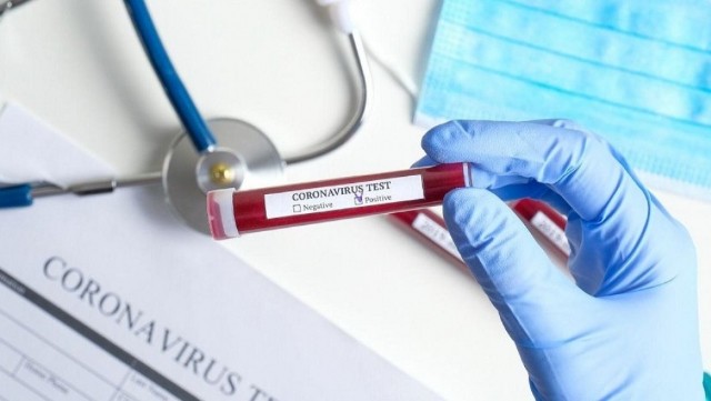 Dünyanın koronavirus MƏNZƏRƏSİ: milyonlarla insan...