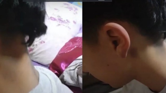Azərbaycanda müəllim şagirdi döyüb, bu hala saldı - VİDEO