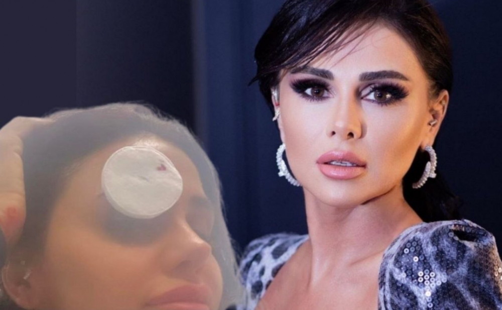 Günel hadisənin necə baş verdiyini açıqladı