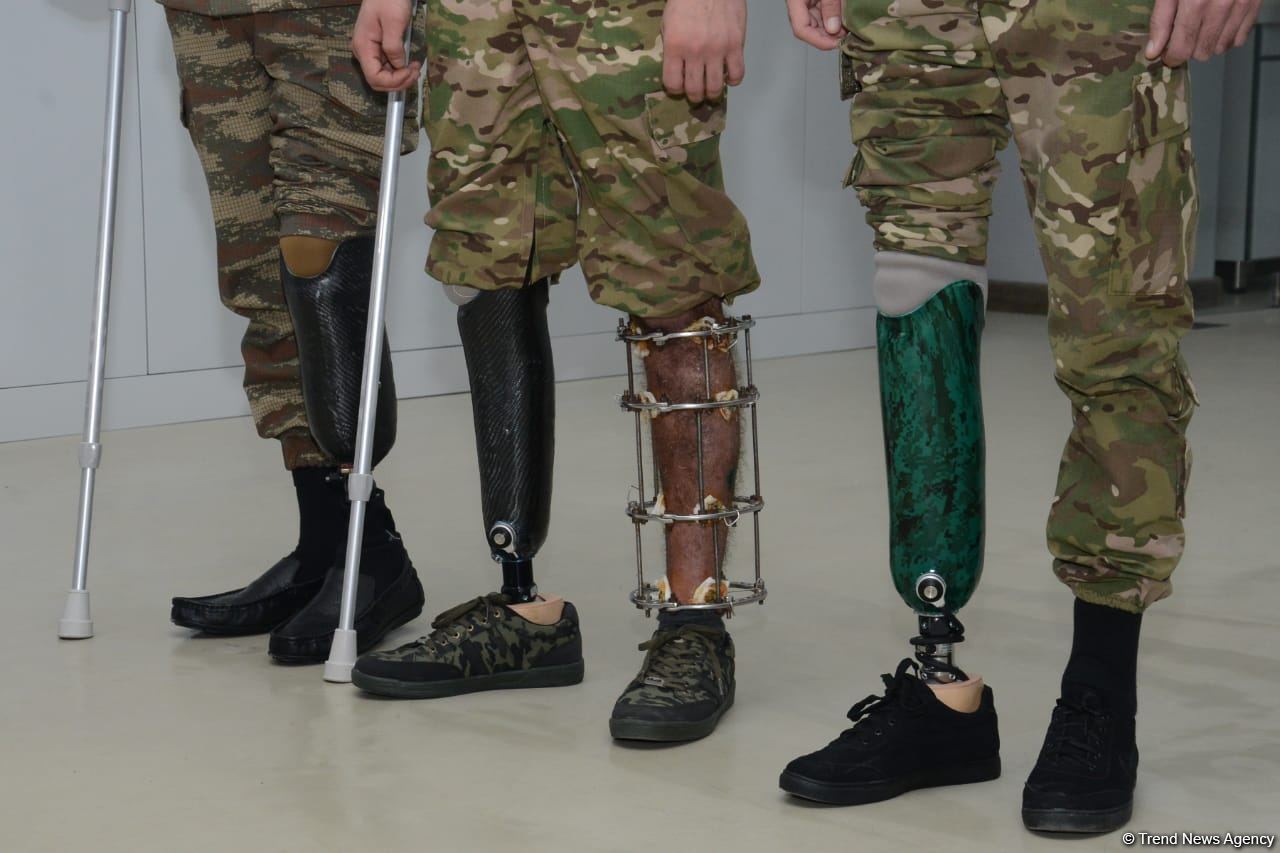 432 hərbçi yüksək texnologiyalı protezlə təmin edilib - RƏSMİ