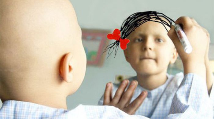 Uşaqlarda onkoloji xəstəliklər ARTIR: 