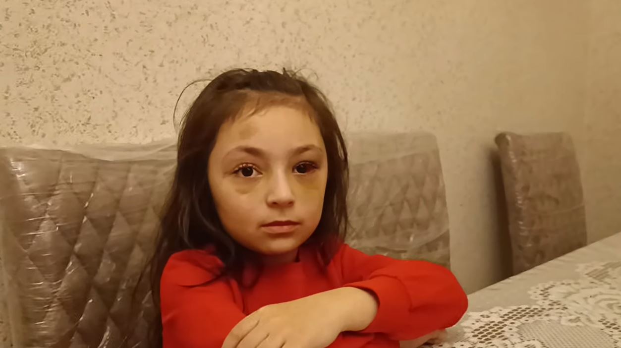 “Direktor maddiyyatla həll etmək istəyirdi” – Döyüldüyü deyilən məktəblinin ANASI + VİDEO