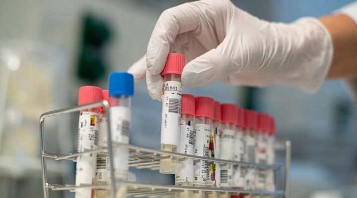 Mutasiyaya uğramış koronavirusun yeni variantı yayıldı – XƏBƏRDARLIQ