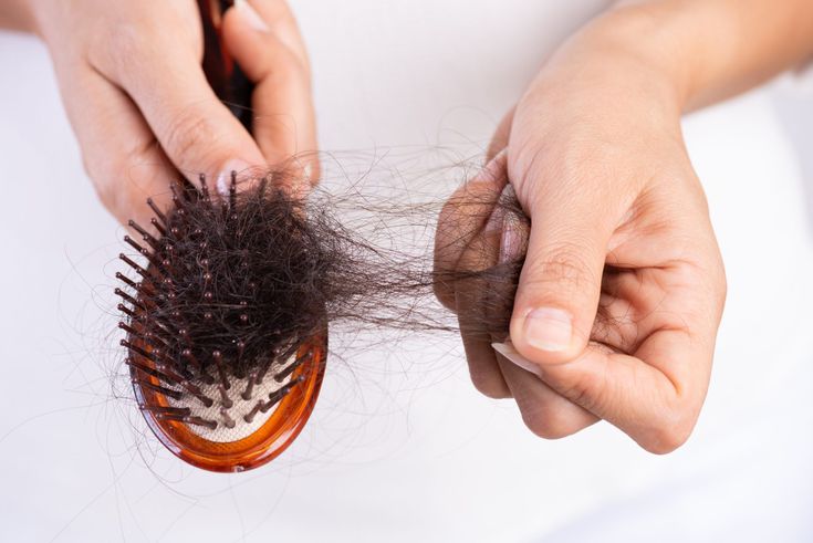 Saç tökülməsinin qarşısını BELƏ ALIN - Mütəxəssisdən faydalı MƏSLƏHƏTLƏR
