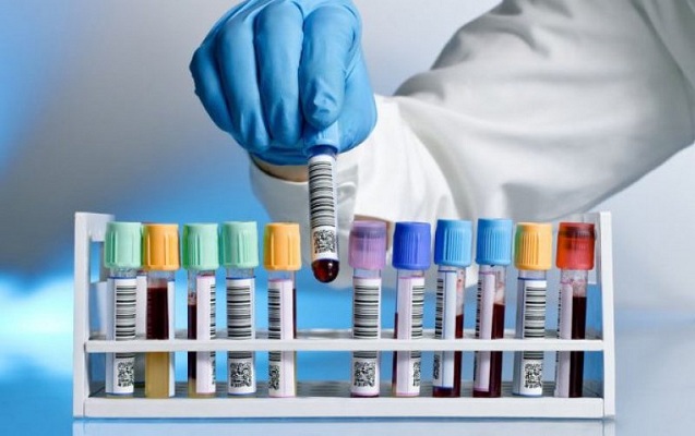 Araşdırma ortaya çıxardı: Bu virus ancaq kişiləri ÖLDÜRÜR