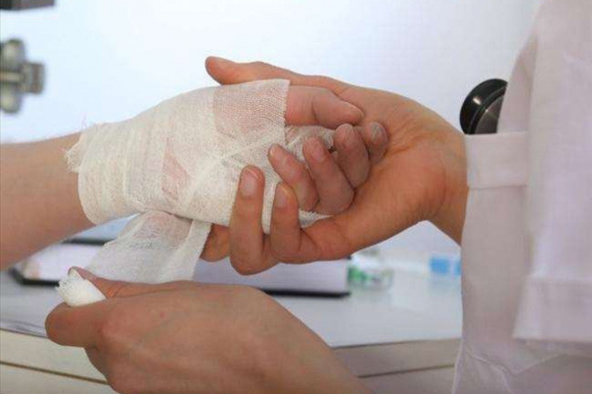Gəncədə qadın özünə xəsarət yetirdi